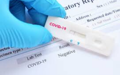 How to get tested for COVID-19  if you do not have medical aid