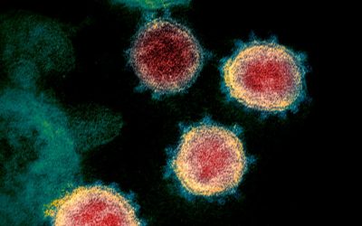 SA COVID-19 Deaths Jump to 13,308 Infections Increase to 613,017