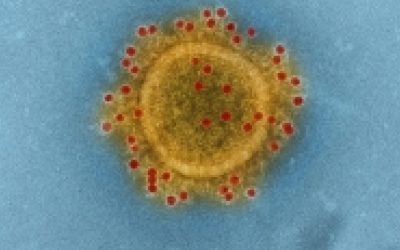 [LISTEN] Dr Aslam Dasoo Warns Gauteng Residents: “This is No Joke, COVID-19 Death Rates are Going to Catch-Up to High Number of Infections”