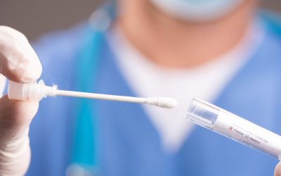 Health department warns of an increase in covid-19 cases