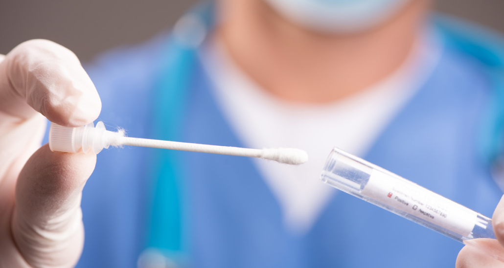 Health department warns of an increase in covid-19 cases