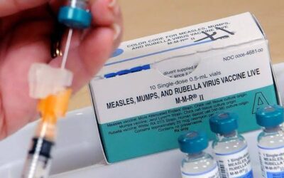 NICD predicts a rise in measles cases across SA